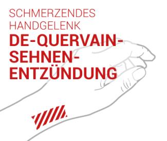 Sehnenscheiden Entzündung DE QUERVAIN