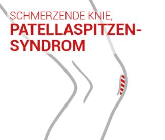 Patellaspitzensyndrom