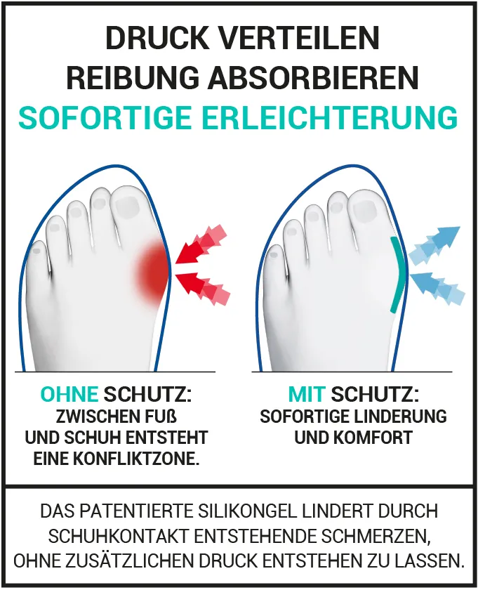 Hallux Valgus schutz epitact